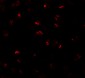 BMP15 Antibody
